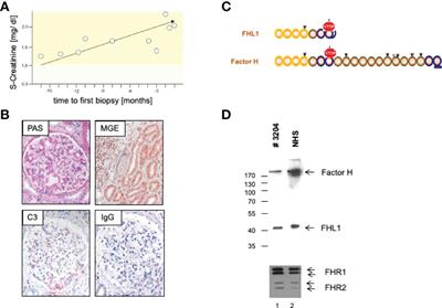 An Interdisciplinary Diagnostic Approach to Guide Therapy in C3 Glomerulopathy